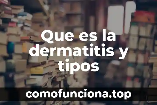 Que es planta libre en arquitectura 8 Que es la dermatitis y tipos